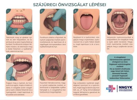 Szájhigiéné Világnapja