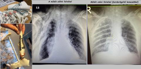 Bordarögzítő lemez